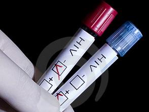 hiv-ilustracija