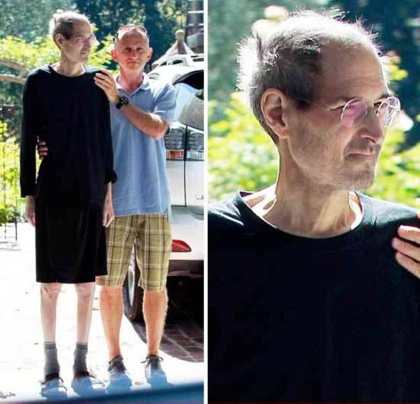 Steve Jobs bolestan