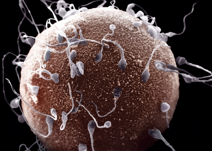 spermic