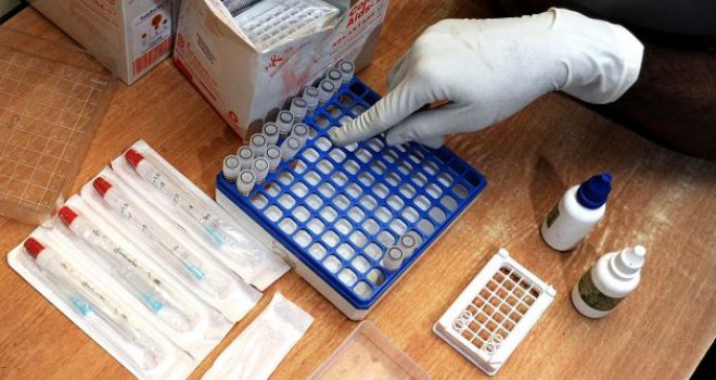 U BiH danas živi 266 osoba sa HIV-om: Ovo su prednosti ranog otkrivanja bolesti