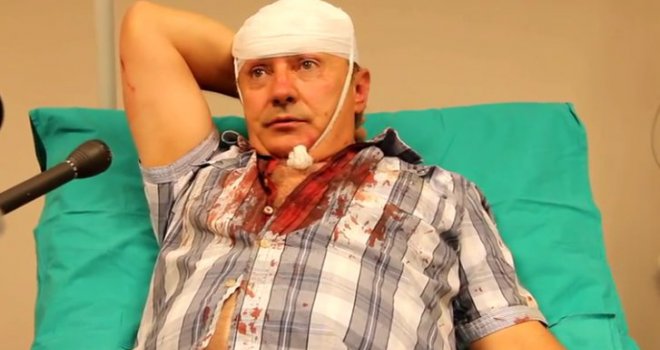 Krivi trag: Ipak nije uhapšen napadač na profesora Kukića!
