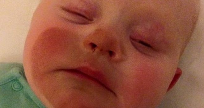 Neiskusna mama: Pogledajte šta se dogodilo ovoj bebi