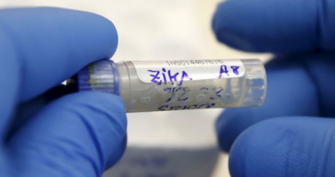 'Zika' virus uzeo maha: Zabilježen prvi slučaj zaraze putem spolnog odnosa!
