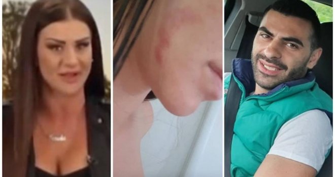 Bivši momak pretukao pjevačicu i učesnicu 'Farme', Sanela tvrdi: Vukao me je po podu i udarao glavom o vrata! 