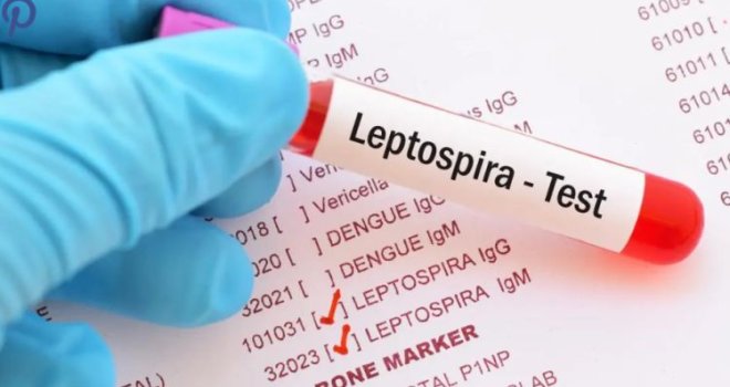 Ovo su upute građanima za prevenciju leptospiroze: Izbjegavati kontakt s potencijalno kontaminiranom vodom, ili zaraženim životinjama