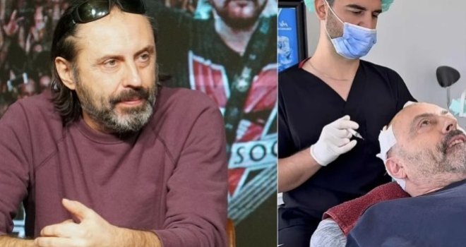Sve za ljepotu: Poznati bh. roker Sejo Sexon presadio kosu... Evo kako izgleda u novom izdanju